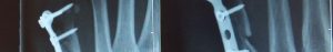 X-rays