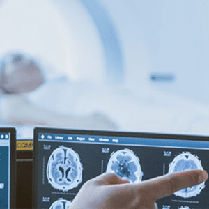 Two doctors examining MRI results